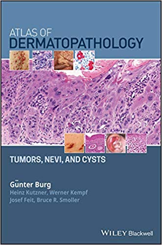 Atlas of Dermatopathology: Tumors, Nevi, and Cysts 2019 - پوست